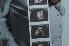 3 months ultrasound scan