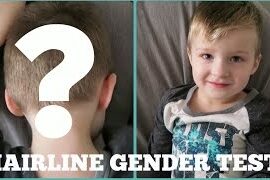 hairline gender predictor