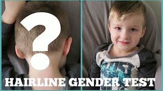 hairline gender predictor