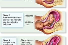 3 stages of labour