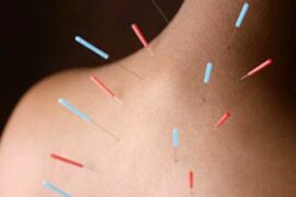 acupuncturists near me