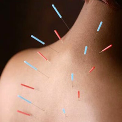 acupuncturists near me