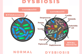 dysbiosis symptoms