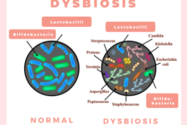 dysbiosis symptoms