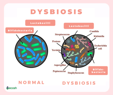 dysbiosis symptoms