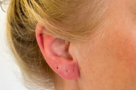 ear infection from piercing