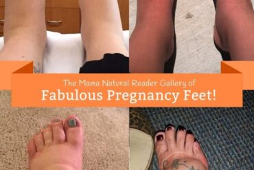 feet swelling and pregnancy