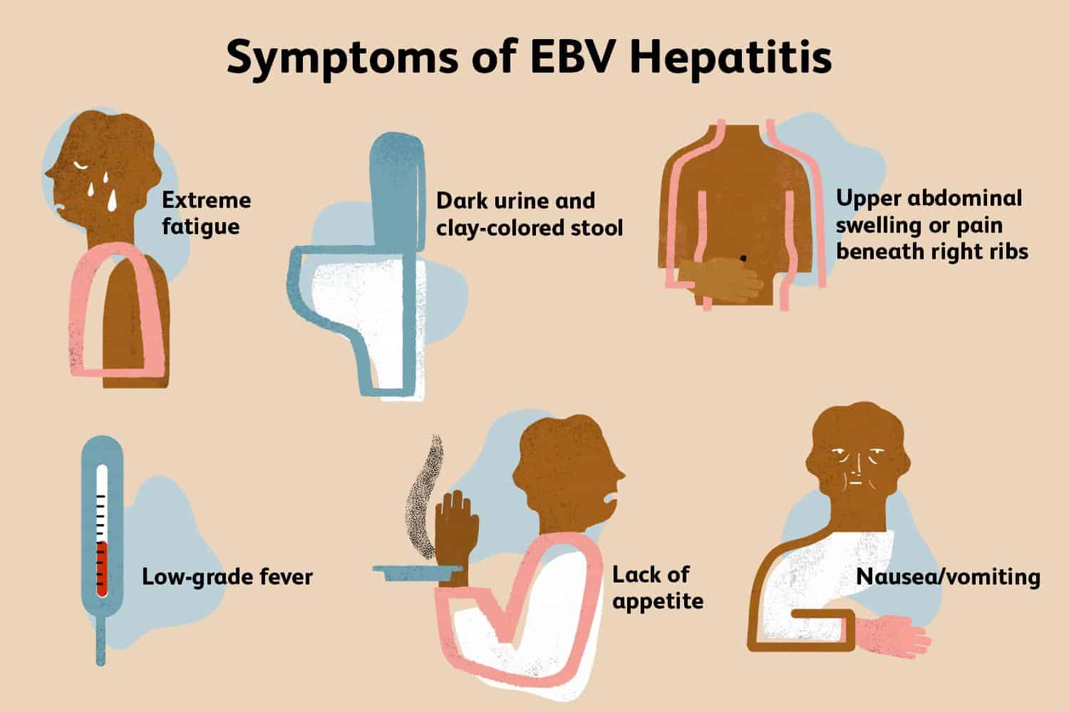 glandular fever signs and symptoms