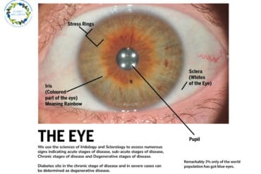 iridology pictures and meanings