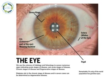 iridology pictures and meanings