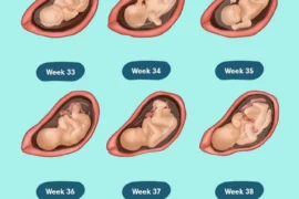 signs of preeclampsia at 32 weeks