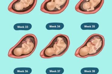 signs of preeclampsia at 32 weeks