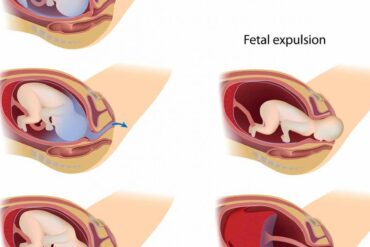 three stages of labor