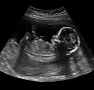 ultrasounds near me