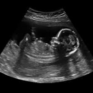 ultrasounds near me