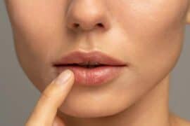 dry lips in pregnancy