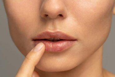 dry lips in pregnancy