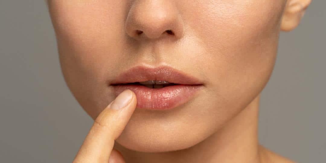 dry lips in pregnancy