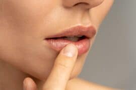 dry lips pregnancy